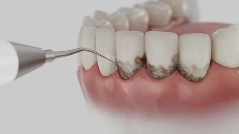 Reliable Dental contractor in Dunlap, IL by Smile Center Dentistry